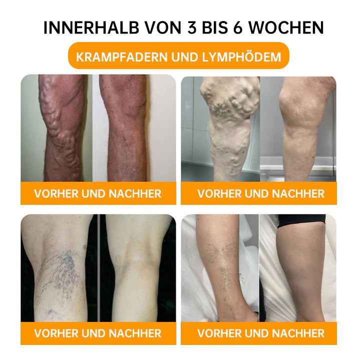 NEGUSY™ 30-Kräuter Schlankheits- und Entgiftungsfußbadperlen - 🦵👩⚕️ (LANA-Zertifizierung, Lymphatische Vereinigung von Amerika)